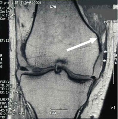 Can X-Rays Show Torn Ligaments? Exploring the Boundaries of Medical Imaging