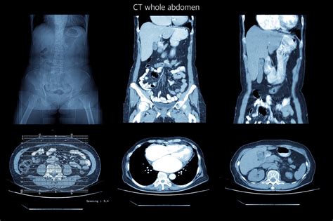 Does CT Scan Show Inflammation: A Multifaceted Exploration into Medical Imaging and Beyond